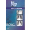 Chest X-Ray: A Survival Guide (Gerald De Lacey)(Brožovaná) Chest X-Ray: A Survival Guide (Gerald De Lacey)(Brožovaná)