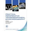 Practical Perioperative Transoesophageal Echocardiography Practical Perioperative Transoesophageal Echocardiography