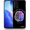 Picasee silikónový čierny obal pre OPPO Reno 5 5G - Brain - White Picasee silikónový čierny obal pre OPPO Reno 5 5G - Brain - White