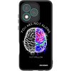Picasee ULTIMATE CASE pro Honor 400 Lite 5G - Brain - White Picasee ULTIMATE CASE pro Honor 400 Lite 5G - Brain - White