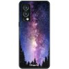 Lesklé puzdro Exclusive iSaprio - Milky Way 11 - OnePlus Nord 2 5G Lesklé puzdro Exclusive iSaprio - Milky Way 11 - OnePlus Nord 2 5G