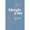 Alergie a my - Theresa MacPhail