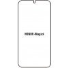 engaroGuard Hydrogel - ochranná fólia - Honor Magic 4 priesvitná nepoužívam kryt = fólia na celý displej 1 kus s výrezom prednej kamery engaroGuard Hydrogel - ochranná fólia - Honor Magic 4 priesvitná nepoužívam kryt = fólia na celý displej 1 kus s výrezom prednej kamery