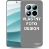 Picasee silikónový čierny obal pre Xiaomi Redmi Note 15 Pro+ - Vlastný design/motiv Picasee silikónový čierny obal pre Xiaomi Redmi Note 15 Pro+ - Vlastný design/motiv