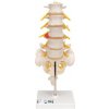 Model bedrovej chrbtice s dorzolaterálnou vyskočenou medzistavcovou platničkou (Anatomické modely) Model bedrovej chrbtice s dorzolaterálnou vyskočenou medzistavcovou platničkou (Anatomické modely)