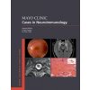 Mayo Clinic Cases in Neuroimmunology (Andrew McKeon,B. Mark Keegan,W. Oliver Tobin)(Brožovaná) Mayo Clinic Cases in Neuroimmunology (Andrew McKeon,B. Mark Keegan,W. Oliver Tobin)(Brožovaná)
