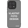 Picasee Ultimate Case pro Xiaomi 15T - Vlastný design/motiv