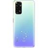 iSaprio číre puzdro – Baran – Xiaomi Redmi Note 11/Note 11S SIMbern-TPU3-RmN11s iSaprio číre puzdro – Baran – Xiaomi Redmi Note 11/Note 11S SIMbern-TPU3-RmN11s