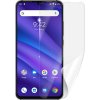 Screenshield UMIDIGI A5 Pro fólie na displej Screenshield UMIDIGI A5 Pro fólie na displej