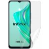 Screenshield INFINIX Hot 20i fólia na displej INF-HOT20I-D Screenshield INFINIX Hot 20i fólia na displej INF-HOT20I-D