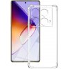 Silikónový kryt pre Infinix Note 40 - Priehľadný Silikónový kryt pre Infinix Note 40 - Priehľadný