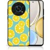 VSETKONAMOBIL 109287 MY ART Ochranný kryt pre Honor Magic4 Lite 5G LEMON (121) VSETKONAMOBIL 109287 MY ART Ochranný kryt pre Honor Magic4 Lite 5G LEMON (121)