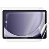 Screenshield SAMSUNG X210 Galaxy Tab A9+ fólia na celé telo SAM-X210-B Screenshield SAMSUNG X210 Galaxy Tab A9+ fólia na celé telo SAM-X210-B