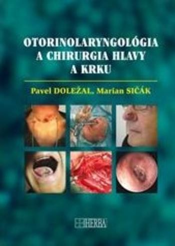 Otorinolaryngológia a chirurgia hlavy a krku - Pavel Doležal; Marian Sičák
