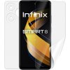 Screenshield INFINIX Smart 8 fólie na celé tělo Screenshield INFINIX Smart 8 fólie na celé tělo