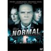 Normal DVD Normal DVD