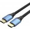 HDMI 2.0 Cable Vention ALHSL, 10m, 4K 30Hz, 28 AWG (Blue) HDMI 2.0 Cable Vention ALHSL, 10m, 4K 30Hz, 28 AWG (Blue)