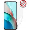 Screenshield pre Anti-Bacteria XIAOMI Mi 11 Lite 5G na displej XIA-MI11LT5GAB-D Screenshield pre Anti-Bacteria XIAOMI Mi 11 Lite 5G na displej XIA-MI11LT5GAB-D