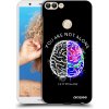Picasee silikónový čierny obal pre Huawei P Smart - Brain - White Picasee silikónový čierny obal pre Huawei P Smart - Brain - White