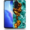 Picasee silikónový čierny obal pre OPPO Reno 5 5G - Goldsky Picasee silikónový čierny obal pre OPPO Reno 5 5G - Goldsky