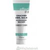 Skineffect Balzam na popraskané päty, 25% Urea 75 ml Skineffect Balzam na popraskané päty, 25% Urea 75 ml