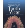 Managing tooth Wear. A comprehensive guide for general practice (Andrea Shepperson)(Pevná) Managing tooth Wear. A comprehensive guide for general practice (Andrea Shepperson)(Pevná)