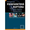Poinfarktová ruptura volné stěny levé komory srdeční - Petr Kačer a kolektiv