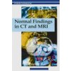 Normal Findings in CT and MRI, A1, print (Emil Reif,Therald Moeller)(Brožovaná) Normal Findings in CT and MRI, A1, print (Emil Reif,Therald Moeller)(Brožovaná)