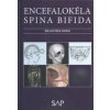 Encefalokéla spina bifida - František Horn Encefalokéla spina bifida - František Horn