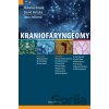 Kraniofaryngeomy - Mikuláš Kosák, David Netuka, Jana Ježková Kraniofaryngeomy - Mikuláš Kosák, David Netuka, Jana Ježková