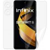 Ochranná fólia Screenshield Infinix Smart 8 - celé tělo