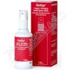 Octizy 1 mg/g+20 mg/g dermálny sprej 1×100 ml Octizy 1 mg/g+20 mg/g dermálny sprej 1×100 ml
