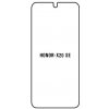 engaroGuard Hydrogel - ochranná fólia - Huawei Honor X20 SE priesvitná nepoužívam kryt = fólia na celý displej 1 kus s výrezom prednej kamery engaroGuard Hydrogel - ochranná fólia - Huawei Honor X20 SE priesvitná nepoužívam kryt = fólia na celý displej 1 kus s výrezom prednej kamery