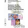 Tumors of the Prostate Gland, Seminal Vesicles, Penis, and Scrotum - Jonathan I. Epstein, Cristina Magi-Galluzzi, Ming Zhou, Antonio L. Cubilla Tumors of the Prostate Gland, Seminal Vesicles, Penis, and Scrotum - Jonathan I. Epstein, Cristina Magi-Galluzzi, Ming Zhou, Antonio L. Cubilla