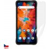 Ochranná fólia Screenshield UMIDIGI Bison X10 - displej