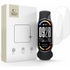 Tech-Protect ochranná fólia na displej Hydro Flex + Xiaomi Smart Band 8 / 9 / 10 / NFC, balenie 2 ks, priehľadná Tech-Protect ochranná fólia na displej Hydro Flex + Xiaomi Smart Band 8 / 9 / 10 / NFC, balenie 2 ks, priehľadná