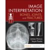 Image Interpretation: Bones, Joints, and Fractures (James Harcus,Voyin Pantic)(Brožovaná) Image Interpretation: Bones, Joints, and Fractures (James Harcus,Voyin Pantic)(Brožovaná)