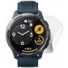 Fólia RedGlass Xiaomi Watch S1 Active 6 ks 92614 Fólia RedGlass Xiaomi Watch S1 Active 6 ks 92614