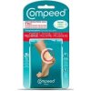 Compeed náplasť na pľuzgiere stredná 5 ks Compeed náplasť na pľuzgiere stredná 5 ks