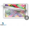 Screenshield™ UMAX VisionBook 10Qi 3G ochranná fólia na displej Screenshield™ UMAX VisionBook 10Qi 3G ochranná fólia na displej