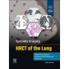 Specialty Imaging: HRCT of the Lung (Melissa L. Rosado-de-Christenson,Santiago Martínez-Jiménez,Sherief H. Garrana)(Pevná) Specialty Imaging: HRCT of the Lung (Melissa L. Rosado-de-Christenson,Santiago Martínez-Jiménez,Sherief H. Garrana)(Pevná)