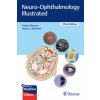 Neuro-Ophthalmology Illustrated (Valerie Biousse,Nancy Newman)(Brožovaná) Neuro-Ophthalmology Illustrated (Valerie Biousse,Nancy Newman)(Brožovaná)