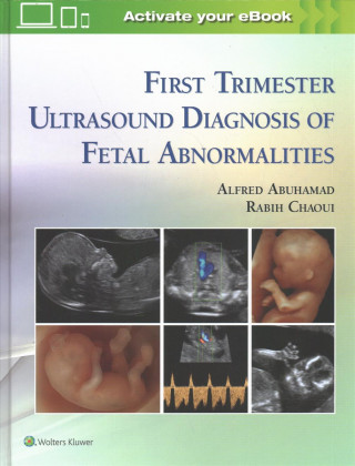 First Trimester Ultrasound Diagnosis of Fetal Abnormalities Abuhamad Alfred Z.