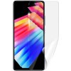 Screenshield INFINIX Hot 30i fólia na displej Screenshield INFINIX Hot 30i fólia na displej