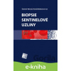 E-kniha Biopsie sentinelové uzliny - Čestmír Neoral, Tomáš Bohanes a kol. E-kniha Biopsie sentinelové uzliny - Čestmír Neoral, Tomáš Bohanes a kol.