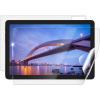 Screenshield IGET Smart L30 FullHD fólie na celé tělo IGT-SML30FHD-B Screenshield IGET Smart L30 FullHD fólie na celé tělo IGT-SML30FHD-B