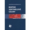 Biopsie sentinelové uzliny Biopsie sentinelové uzliny