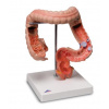 Črevné choroby (Anatomické modely) Črevné choroby (Anatomické modely)