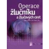 Operace žlučníku a žlučových cest Operace žlučníku a žlučových cest