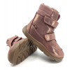 Froddo G3160240-6 Pink/Gold Veľkosť: 28, Vnútorná dĺžka topánky: 18,2 cm, Vnútorná šírka topánky: 6,8 cm Froddo G3160240-6 Pink/Gold Veľkosť: 28, Vnútorná dĺžka topánky: 18,2 cm, Vnútorná šírka topánky: 6,8 cm